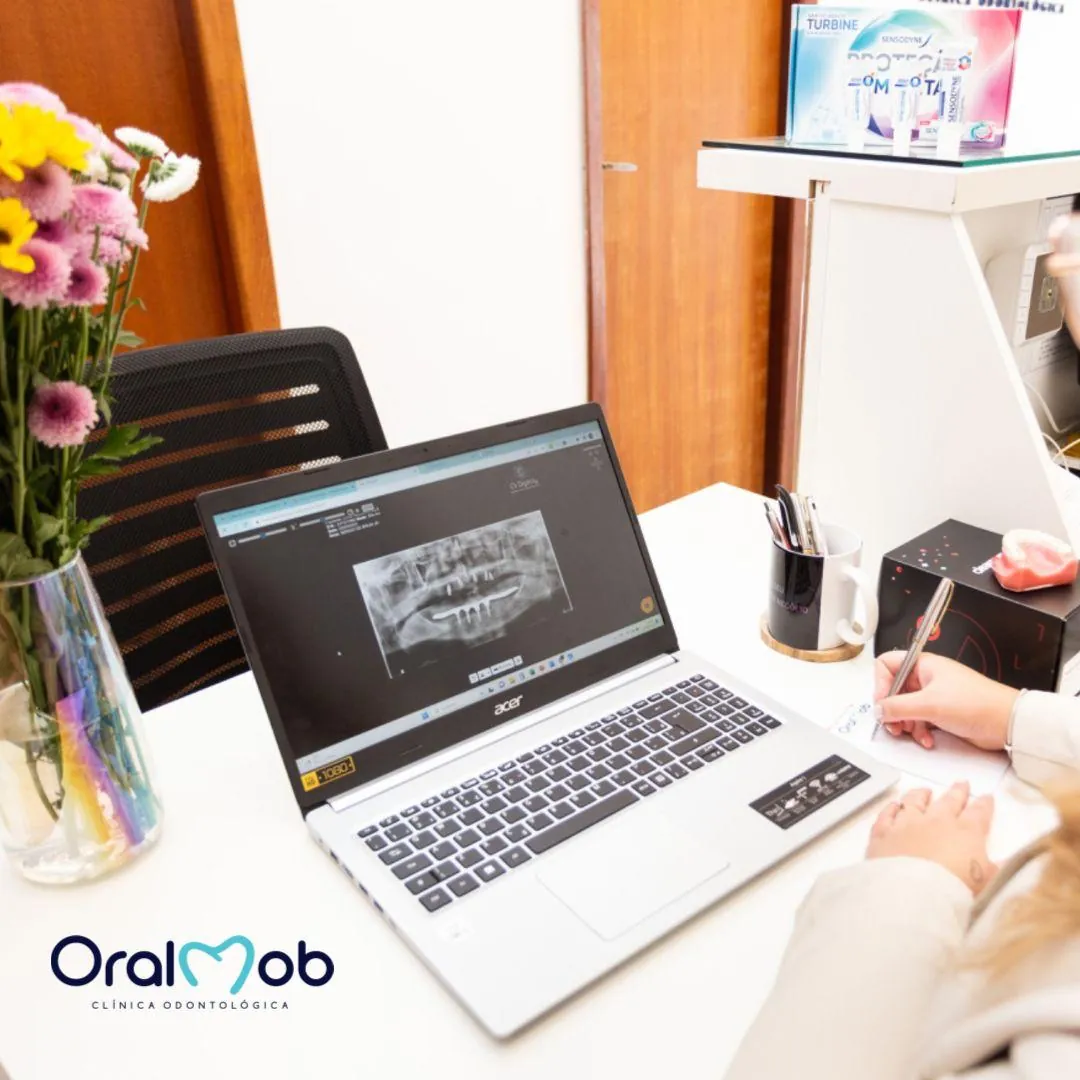Planejamento digital com tomografia na Oralmob